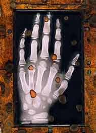Hand X-Ray 4